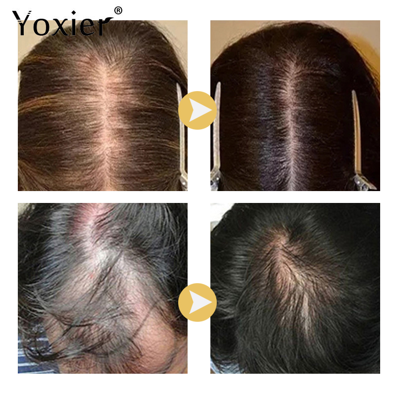 Intensywne Serum wzrostu zapob – Hair Care Serum recenzja i cena